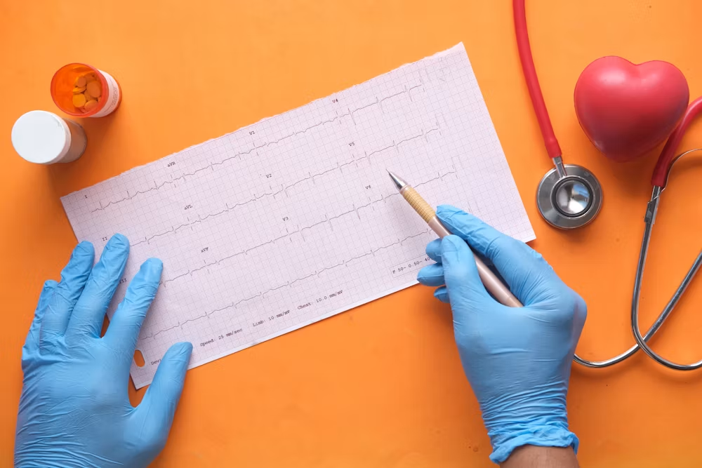 ECG Testing